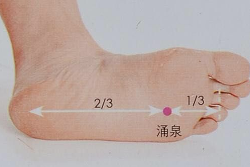 艾灸涌泉穴 艾灸涌泉穴
